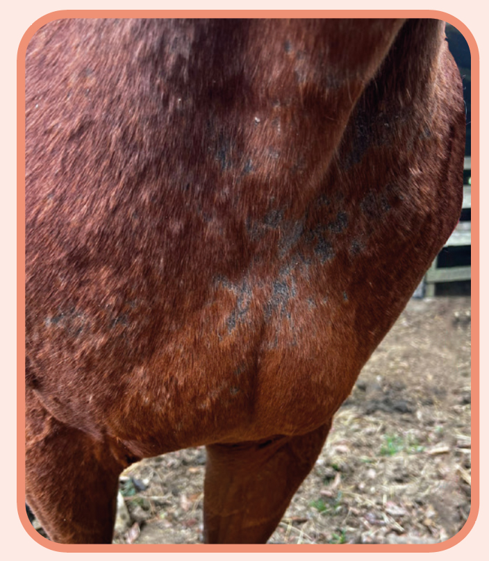 Caso Clínico APTIMA ESTIDERM